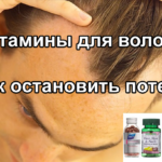 Выпадение волос: какие витамины нужны, лучшие витамины против облысения