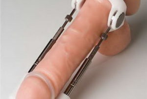 Экстендер для увеличения мужского полового члена в домашних условиях