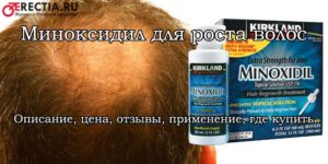 Миноксидил для мужчин и женщин: цены, применение, показания, инструкция, где купить, отзывы