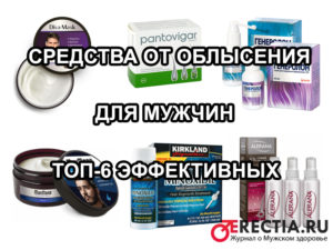лучшие, эффективные средства от облысения у мужчин - топ 6